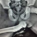 Never put your feet on the dashboard