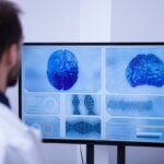 Stroke support in Torrevieja