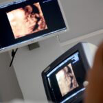Ultrasound Machine