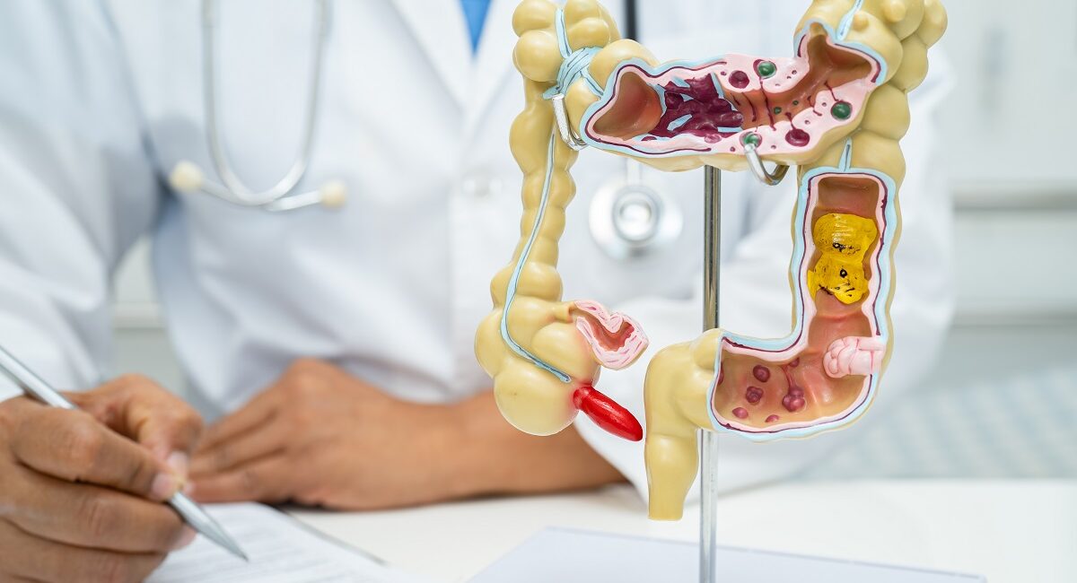Intestine, appendix and digestive system, doctor holding anatomy model for study diagnosis and treatment in hospital.